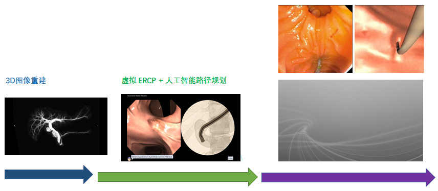 刘允怡院士团队：智能外科手术4.0