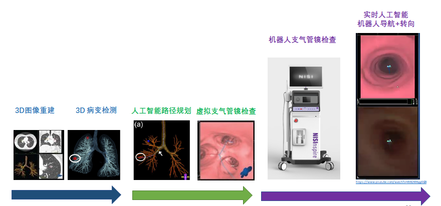 刘允怡院士团队：智能外科手术4.0